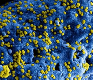 Microscopic view of yellow virus particles on a blue surface, showcasing intricate details.